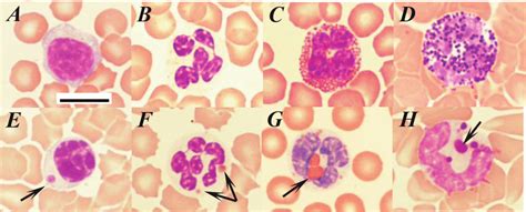 Blood lymphocytes (A, E), segmented neutrophils (B, F), eosinophils (C,... | Download Scientific ...