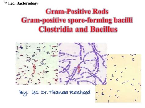 PPT - Aerobic Non-Spore Forming Gram-Positive Bacilli PowerPoint Presentation - ID:709766