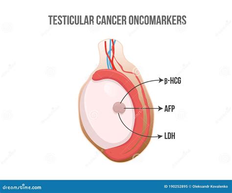 Testicular Cancer : Testicular Cancer What To Know Summit Health - With ...