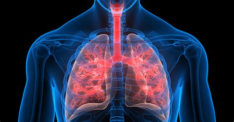 Radiation Therapy for Early-Stage Lung Cancer | Fox Chase Cancer Center - Philadelphia PA