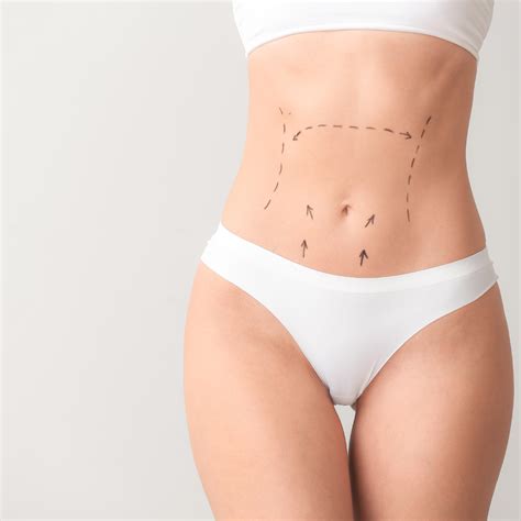 Liposuction Vs. CoolSculpting - The Bend Magazine