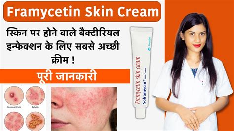 Framycetin Skin Cream Kis Kaam Me Aata Hai | Framycetin Skin Cream | Uses | how To Use | Side ...