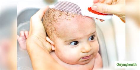 Here Are 6 Tips To Improve Newborn Baby Hair Growth | OnlyMyHealth