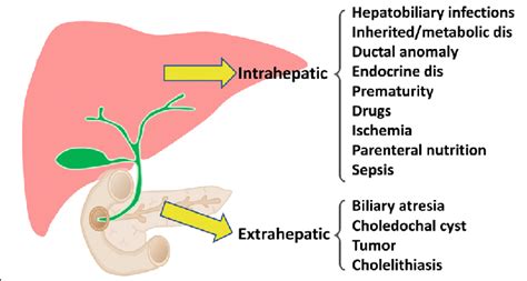 Etiologies of intrahepatic and extrahepatic cholestasis of inherited or ...