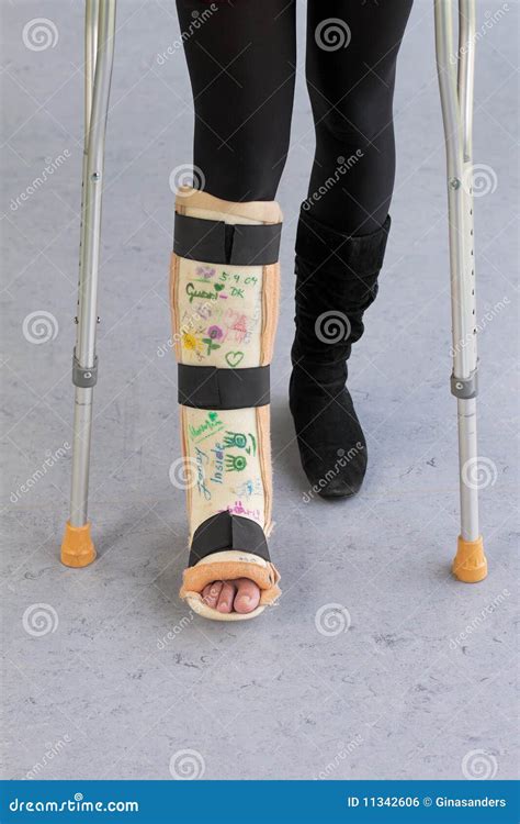 Leg Cast And Crutches Royalty Free Stock Image - Image: 11342606