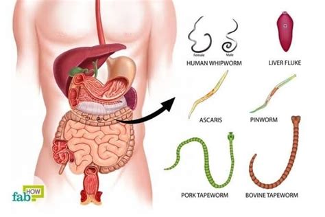 Types Of Parasitic Worms In Humans