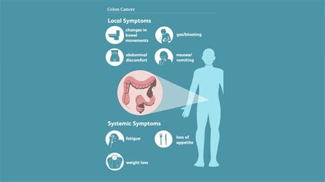 What Is Colorectal Cancer And What Are Its Symptoms, Causes, And Treatment?