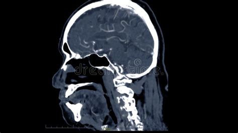 143 Ct Scan Brain Contrast Media Stock Photos - Free & Royalty-Free Stock Photos from Dreamstime