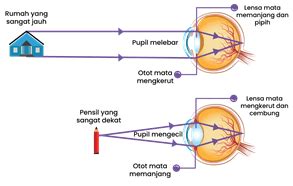 Kemampuan Menebal Dan Memipih Pada Lensa Disebut