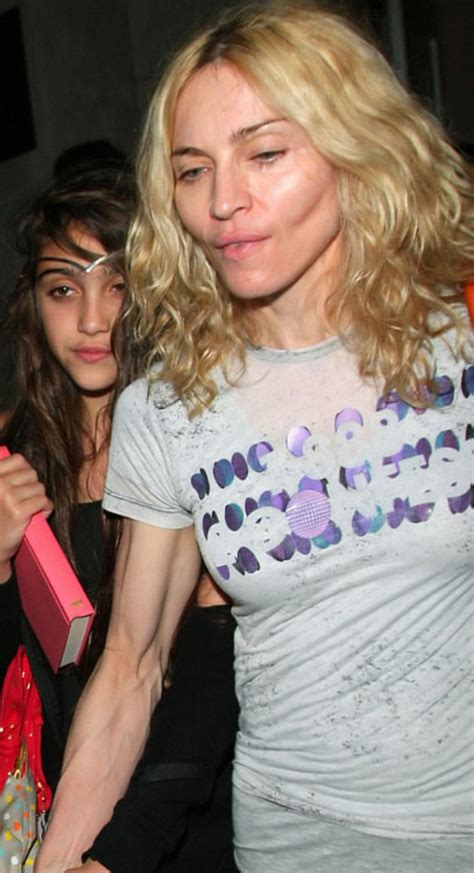 Celebrity Madonna - plastic surgery, photos, video