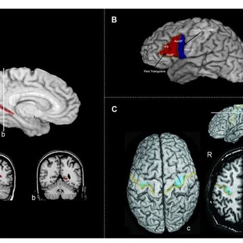 (A) The calcarine sulcus. The calcarine sulcus cortex (red) ROI... | Download Scientific Diagram