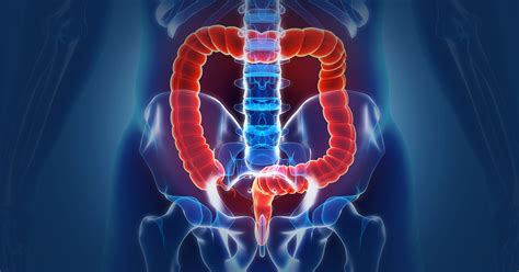 Anal Fissures – Treatment & Diagnosis | MedStar Health