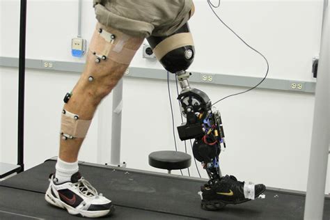 Effects of a Powered Knee-Ankle Prosthesis on Amputee Hip Compensations ...