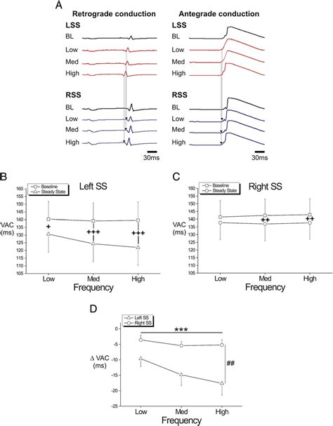 Effect of unilateral sympathetic stimulation on myocardial dromotropy ...