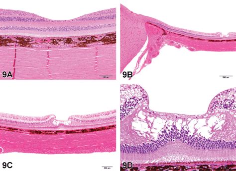 Macula Lutea Histology