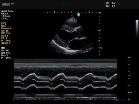 Ultrasound Design and Operation | Oncology Medical Physics