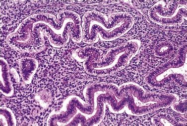 The Normal Endometrium | Basicmedical Key