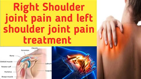 Shoulder joint pain treatment right shoulder and left shoulder joint ...