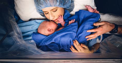 C-Section Birth Photography | POPSUGAR Family