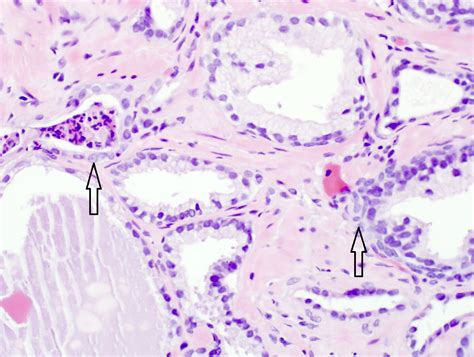 Histology Of Prostate