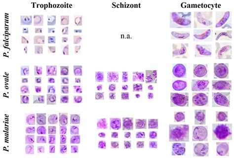 Sensors | Free Full-Text | Mobile-Based Analysis of Malaria-Infected ...