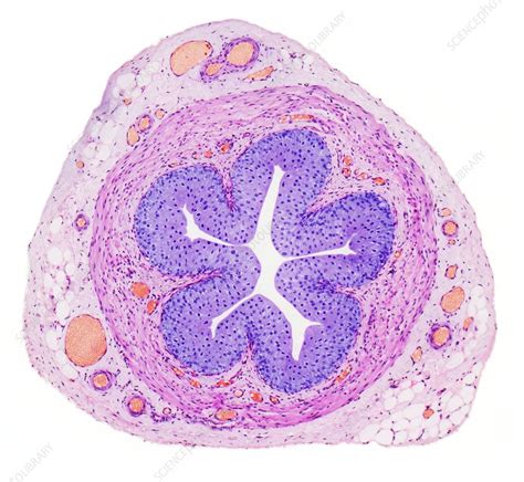 Ureter, light micrograph - Stock Image - C023/8266 - Science Photo Library