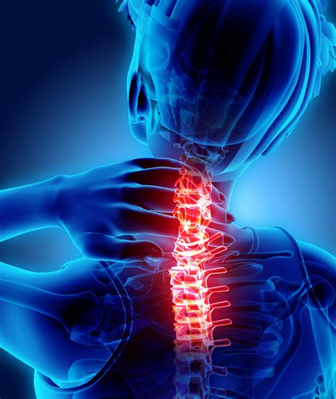 Factors associated with physical activity participation in adults with chronic cervical spine ...