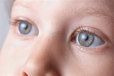 Cortical Visual Impairment: What Is It? - Discovery Eye Foundation