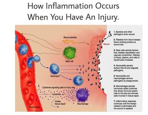 What Causes Inflammation?