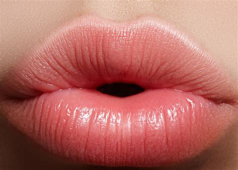 Botox Lip Flip Explained – 10 Things You Need to Know