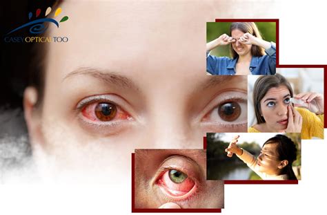 Conjunctivitis (pink eye) Symptoms, Causes, Treatment, Prevention ...