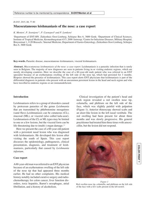 (PDF) Mucocutaneous leishmaniasis of the nose: a case report