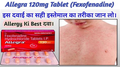 Fexofenadine Hydrochloride 120 mg Hindi | Allegra 120 mg uses in Hindi | Side Effects & Doses ...