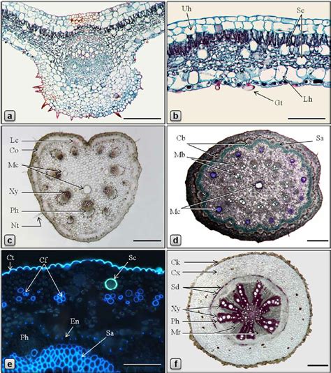 Anatomy of Piper betle. (a-d, f: LM; e: fluorescence microscopy, UV Ex... | Download Scientific ...