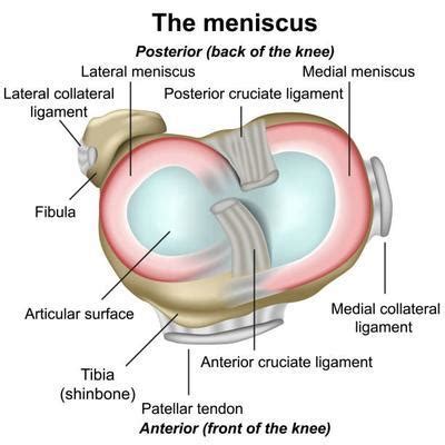 Meniscal Tear Variations: Why You Can't Compare Apples to Oranges ...