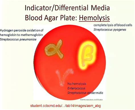 Beta Hemolysis On Blood Agar - cloudshareinfo