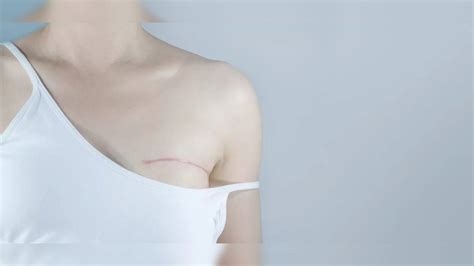 Mastectomy vs. Lumpectomy: What is the difference?