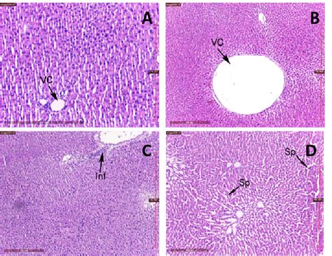 Histological aspects of hepatic tissue in control (A), diabetic (B), DL... | Download Scientific ...