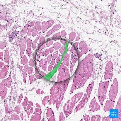 Skeletal muscle tissue: Histology | Kenhub