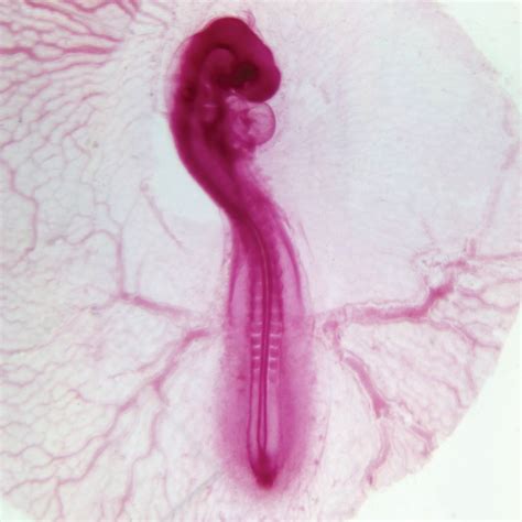 Chick Embryo, 48 hour Microscope Slides | Carolina.com