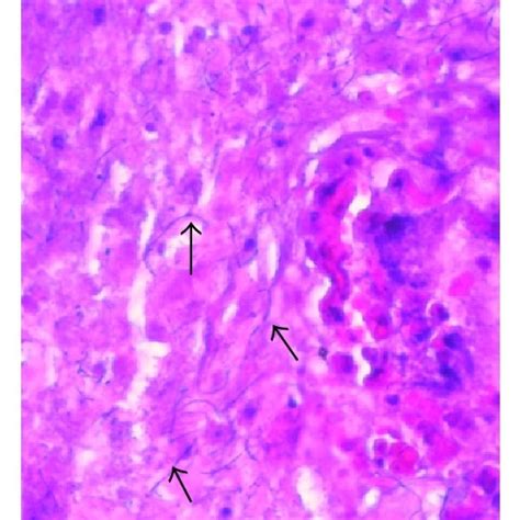 (a) Gram stain (×40). Arrows point toward Gram-positive filamentous... | Download Scientific Diagram