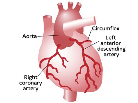 Coronary Artery Disease CAD- Ischaemic Heart Disease - Heart Foundation