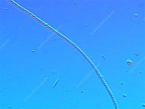 Anabaena algae - Stock Video Clip - K002/1564 - Science Photo Library