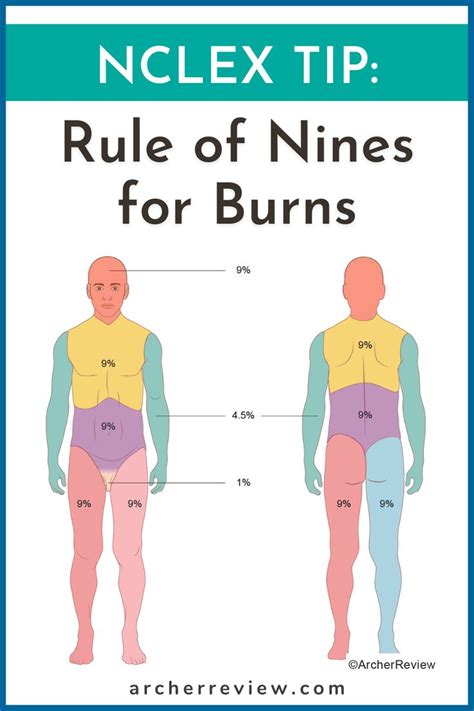 NCLEX Tip: Rule of Nines for Burns | Nclex, Rule of nines, Nursing school motivation