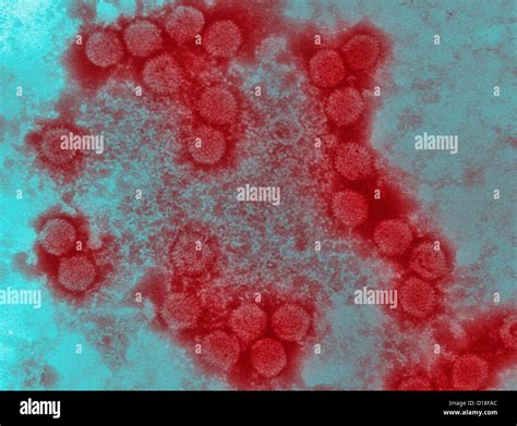 Electron micrograph of canine adenovirus Stock Photo - Alamy