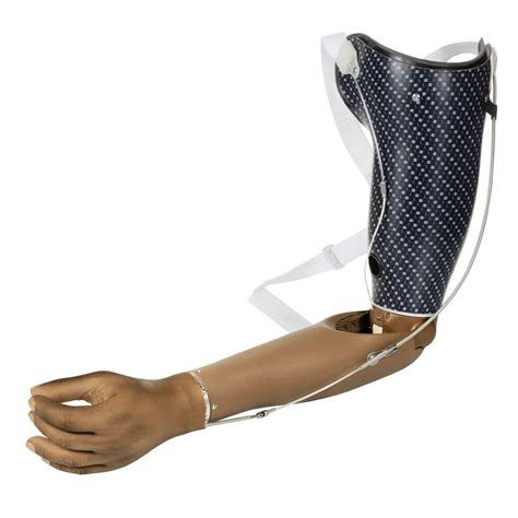 Care4you Functional Prosthetic Cable Operated (Body-Powered) Prosthesis Upper Arm, Rs 45000 ...