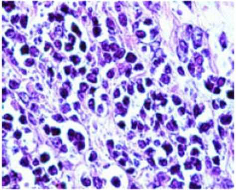 Lymphoma in Syrian Hamster