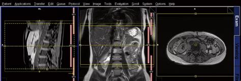 Body MRI - Zwanger-Pesiri Radiology