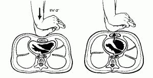 How deep should you compress the chest during chest compressions? | First Aid for Free