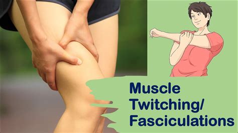 Muscle Twitches/ Fasciculations :- Causes & treatment. - YouTube